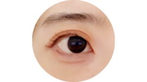 ホットビューラー